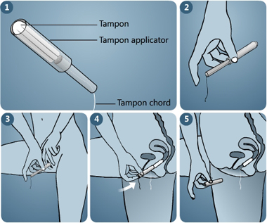 inserting tampon